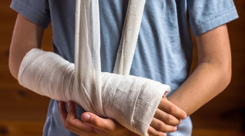 Bị Gãy Xương: Dấu Hiệu, Cách Xử Trí Sơ Cứu Và Phác Đồ Điều Trị