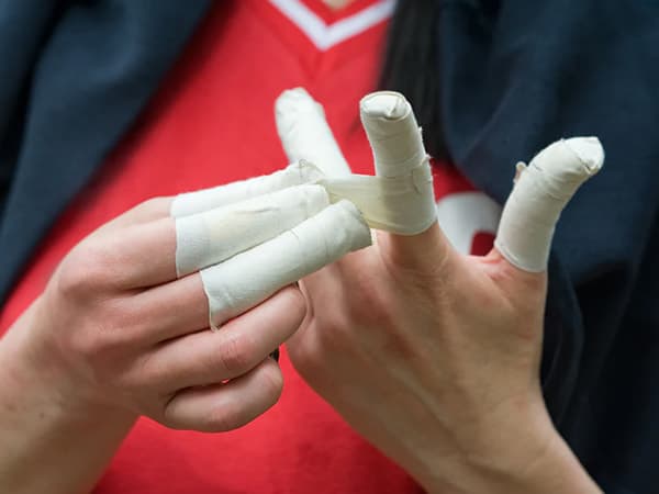 Chấn Thương Ngón Tay Khi Chơi Bóng Chuyền Và Những Lưu Ý Cần Biết