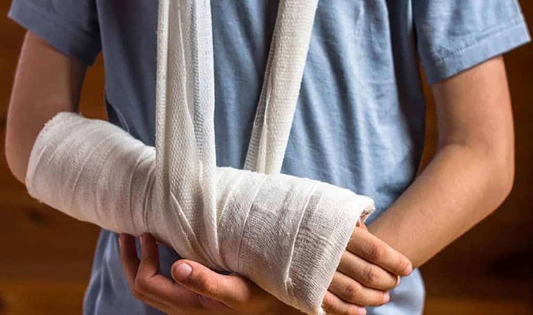 Dấu Hiệu Bị Gãy Xương: Nhận Biết Sớm Và Điều Trị Kịp Thời