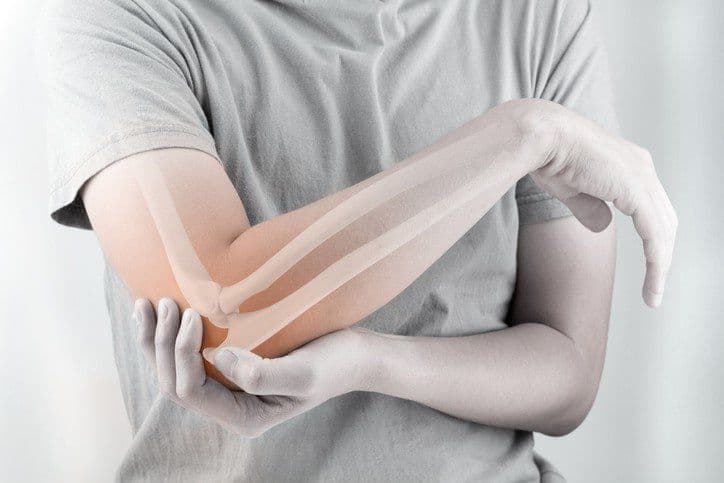 Dấu Hiệu Của Gãy Xương: Nhận Biết Sớm Để Xử Trí Đúng Cách