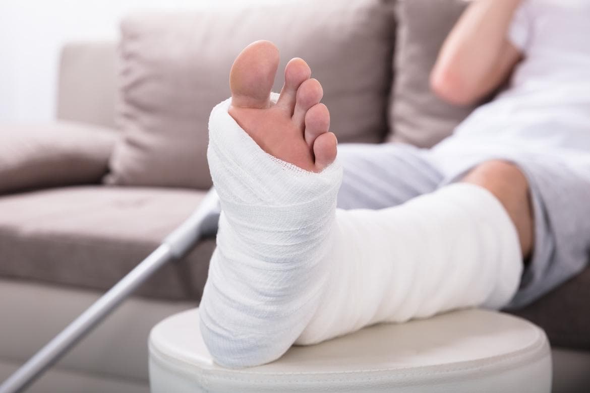 Gãy Xương Bàn Chân: Dấu Hiệu Nhận Biết Và Phác Đồ Điều Trị Phục Hồi