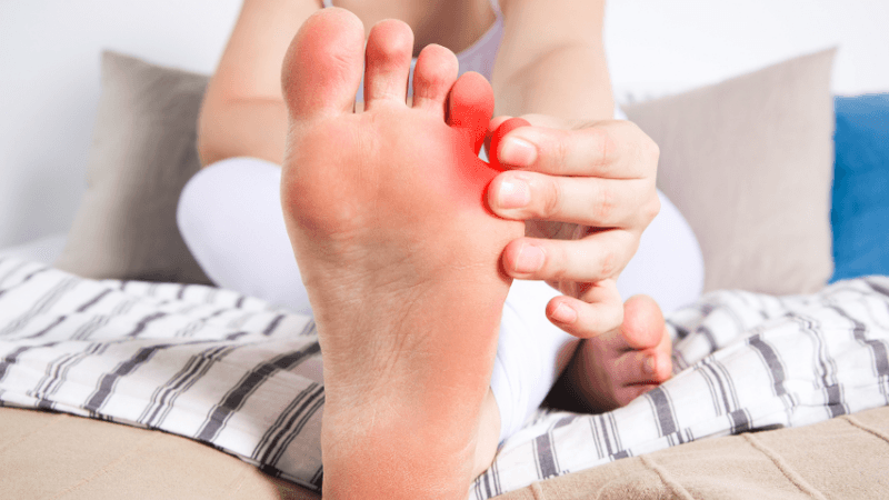 Gãy Xương Bàn Chân Số 5 Bó Bột Bao Lâu?