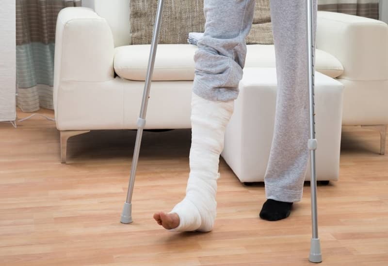 Gãy Xương Bao Lâu Thì Lành? Yếu Tố Ảnh Hưởng Và Tiến Trình Hồi Phục
