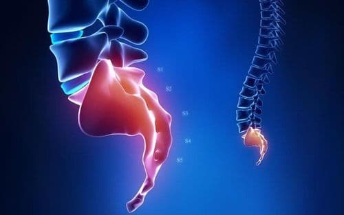 Gãy Xương Cụt: Dấu Hiệu, Nguyên Nhân Và Phương Pháp Điều Trị Hiệu Quả