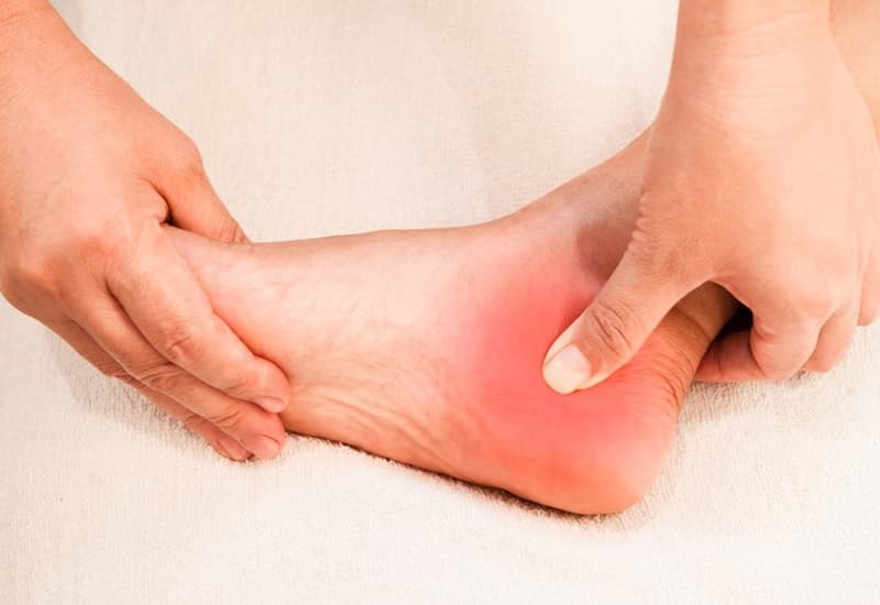 Gãy Xương Gót Chân: Dấu Hiệu Nhận Biết Kịp Thời
