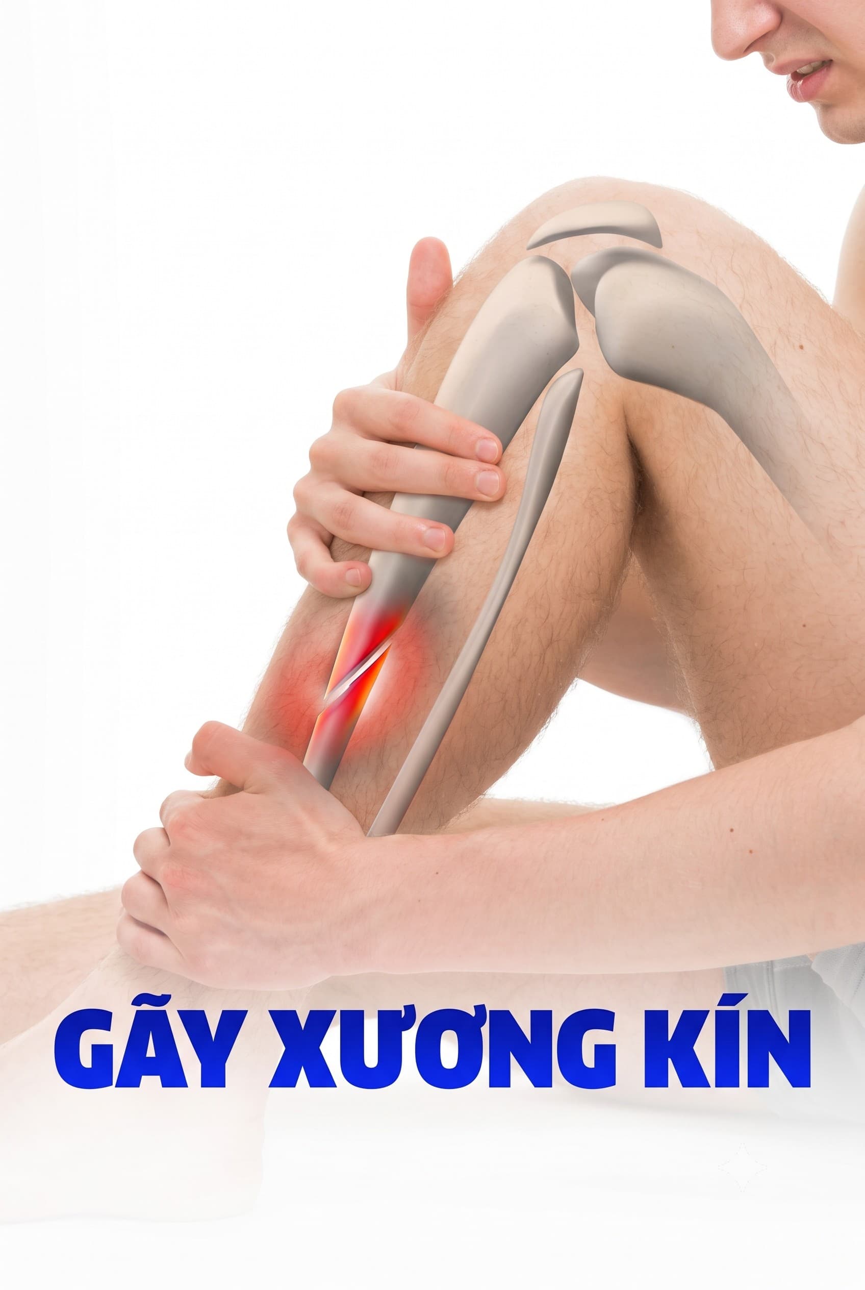 Gãy Xương Kín: Dấu Hiệu Nhận Biết, Phân Loại Và Phác Đồ Điều Trị Phục Hồi