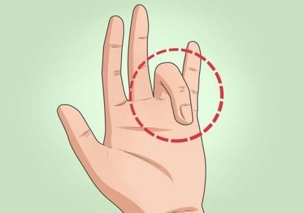 Gãy Xương Ngón Tay Áp Út: Nguyên Nhân, Dấu Hiệu Và Phương Pháp Điều Trị
