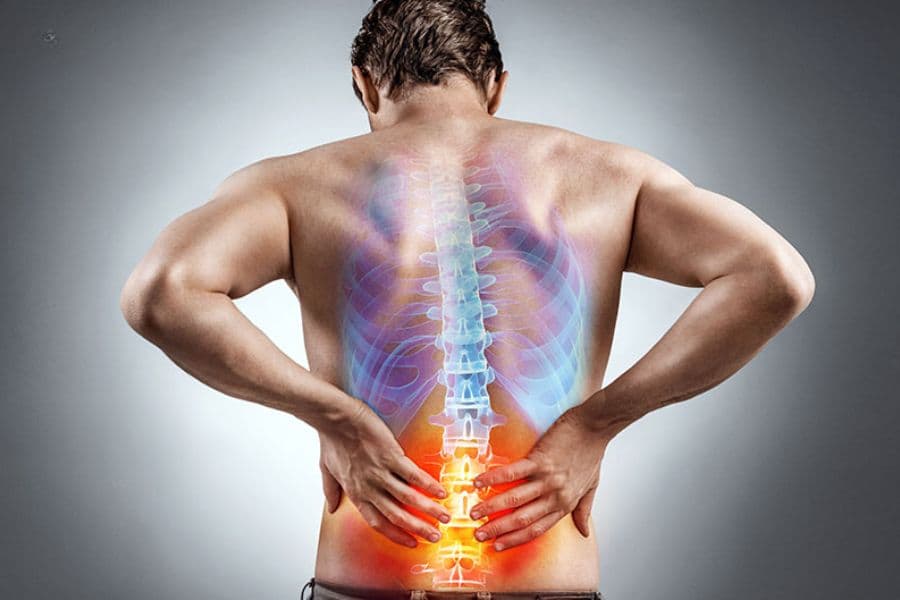 Gãy Xương Sống: Dấu Hiệu, Biến Chứng Và Phác Đồ Điều Trị Chuẩn Y Khoa