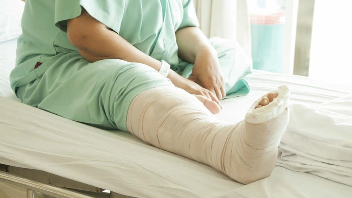 Triệu Chứng Của Gãy Xương: Dấu Hiệu Nhận Biết Sớm